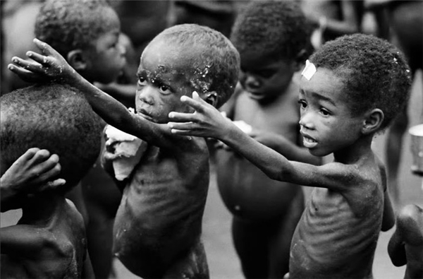 Khoảng 1,4 triệu trẻ em Phi châu đang bị đe dọa chết vì thiếu dinh dưỡng trầm trọng